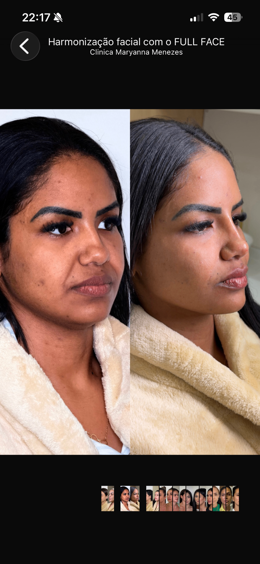 Full Face — caso 3